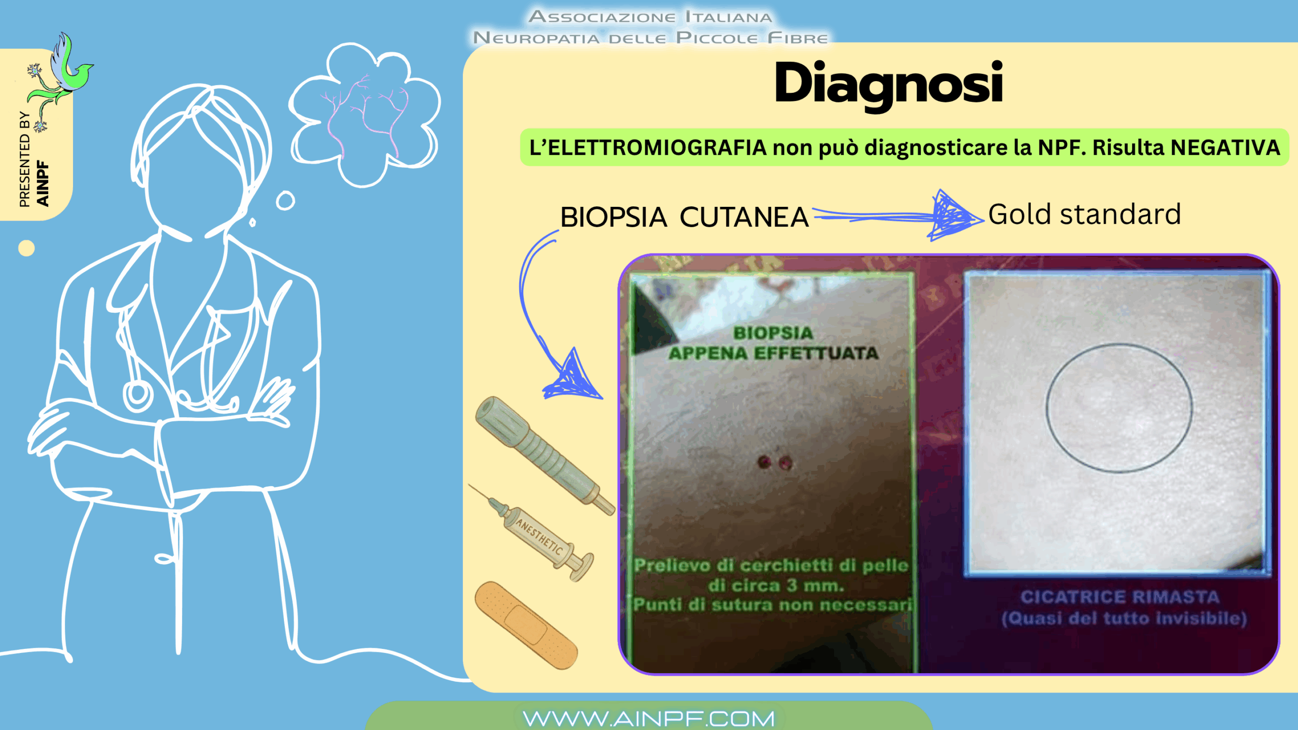 biopsia neurologica di cute