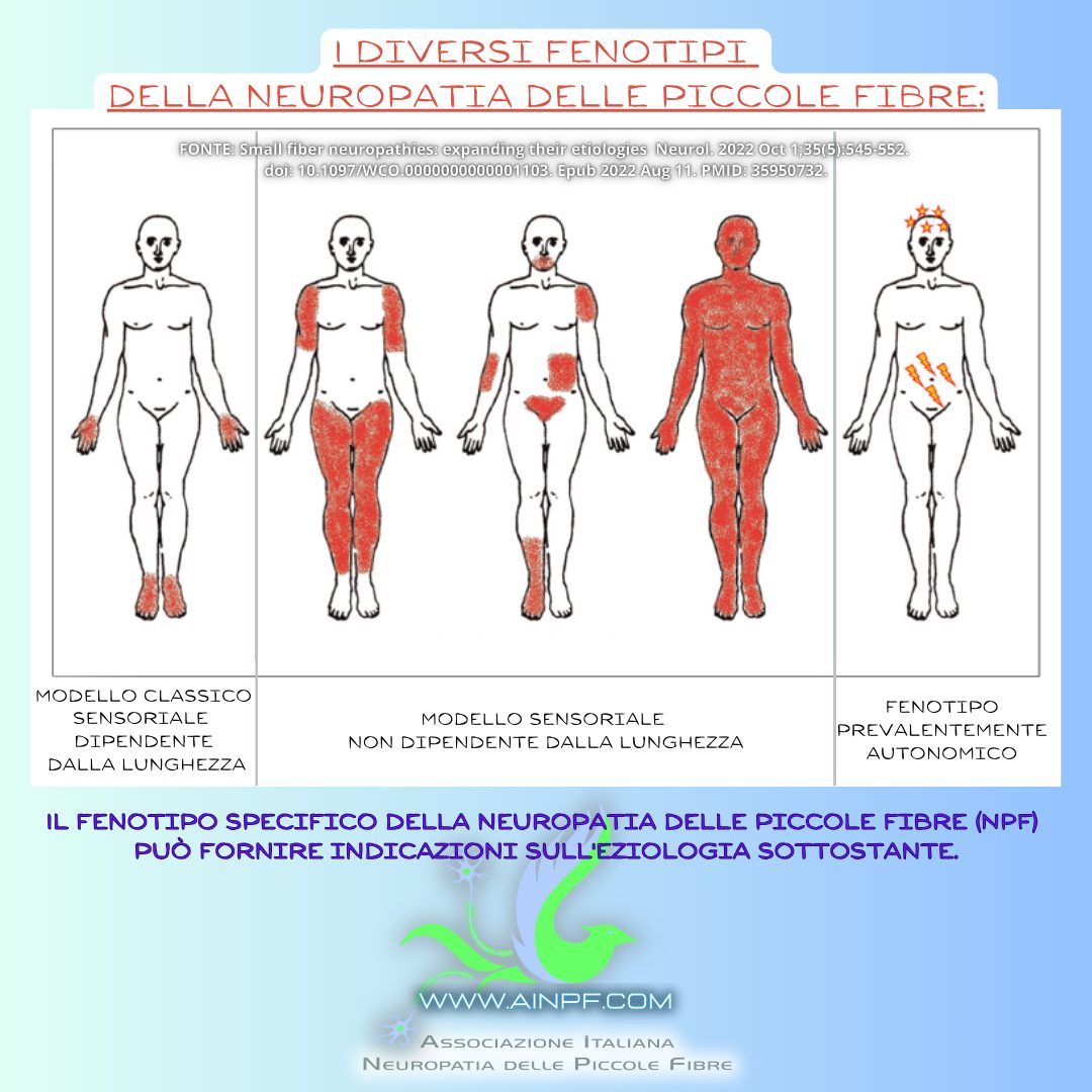 distribuzione NPF